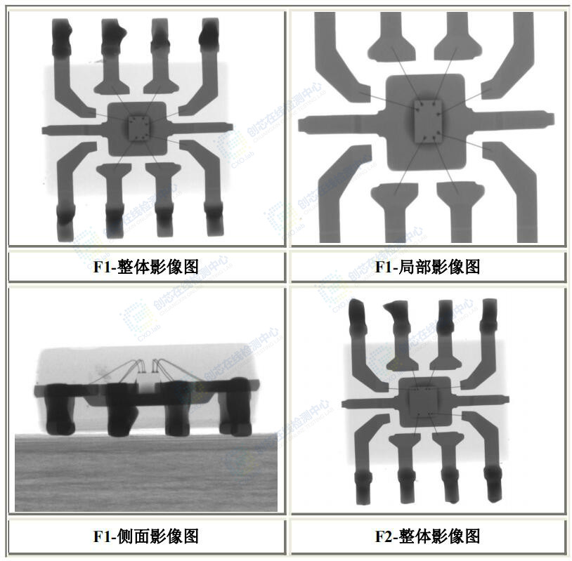 X-ray jiancha.jpg